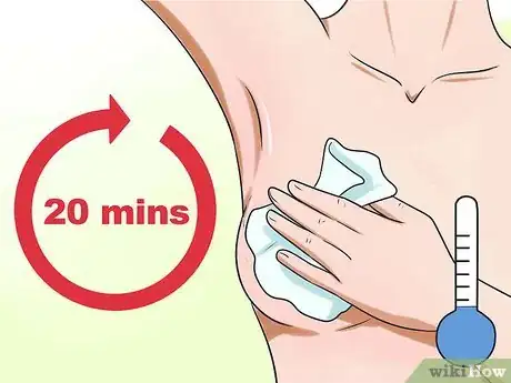 Image titled Soothe Sore Nipples Step 15