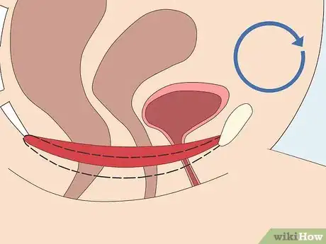 Image titled Do Bladder Training for Sudden Urges to Pee Step 12