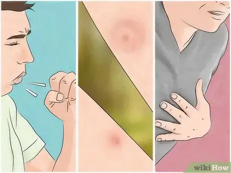 Image titled Get Rid of Bug Bites Step 25