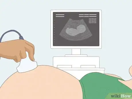 Image titled Tell if You're Pregnant with a Girl or Boy Step 17