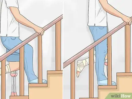 Image titled Go Upstairs with Crutches Step 10