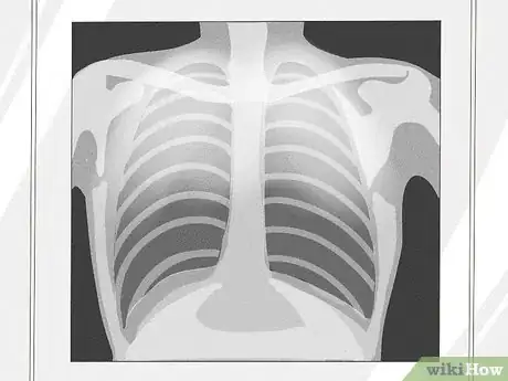 Image titled Know if a Chest X Ray Film Is Rotated Step 6