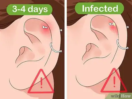 Image titled Clean a Cartilage Piercing Step 8