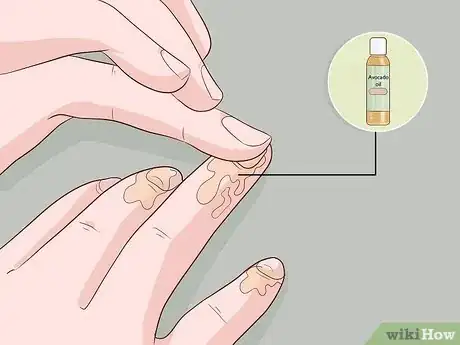 Image titled Care for Your Nails Step 4