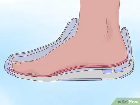 Image titled Fix Pronated Feet Step 1