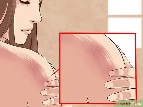 Image titled Perform Melanoma Skin Checks Step 11