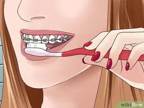 Image titled Brush Your Teeth With Braces On Step 2