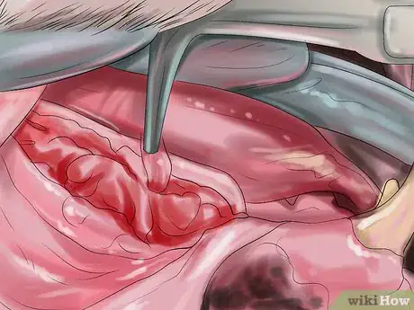 Image titled Deal with Tooth Resorption in Cats Step 9