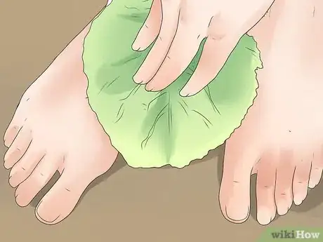 Image titled Get Rid of Gout when Pregnant Step 5