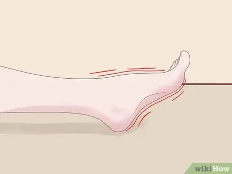 Image titled Know if Your Have Neuropathy in Your Feet Step 6