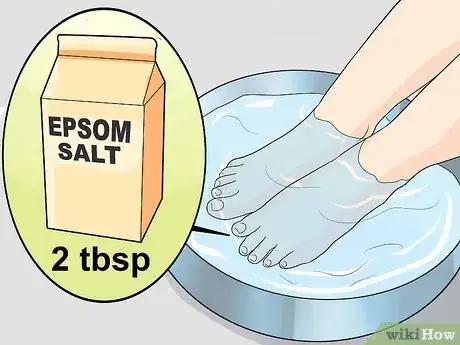 Image titled Heal an Ingrown Toenail Step 1