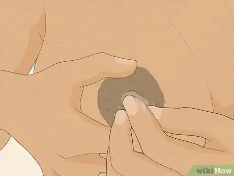 Image titled Avoid Sore Nipples While Breast Feeding Step 17