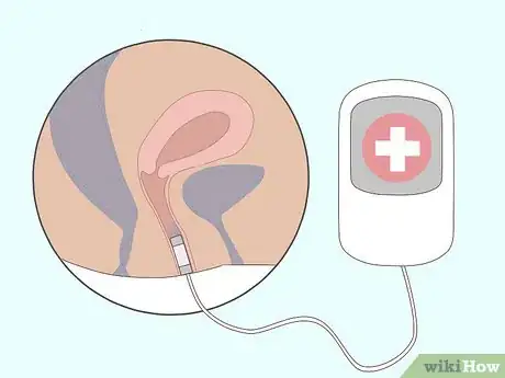 Image titled Do Kegel Exercises Step 15