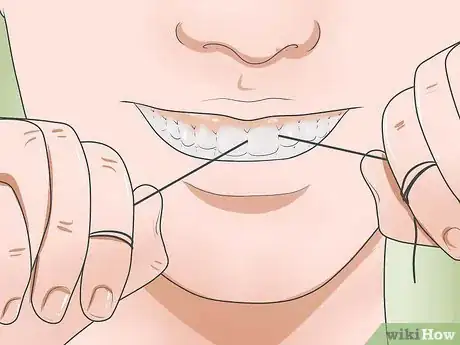 Image titled Reduce Gum Swelling Step 3