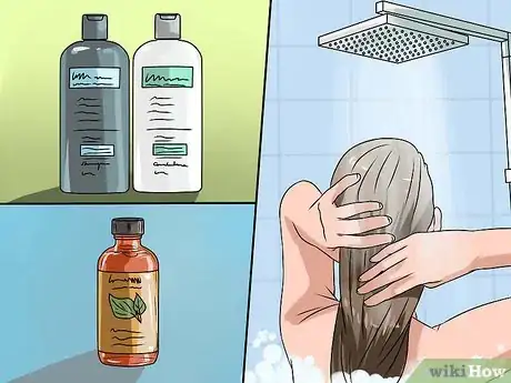 Image titled Remove Dandruff Using Vinegar Step 1