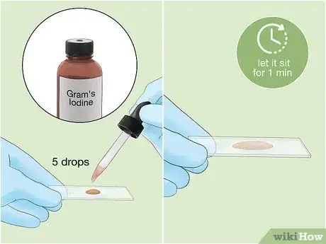 Image titled Identify Bacteria Step 6