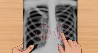 Read a Chest X Ray