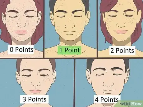 Image titled Determine Fitzpatrick Skin Type Step 4