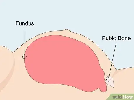 Image titled Measure Fundal Height Step 13