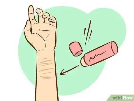 Image titled Get Rid of Self Harm Scars Step 16