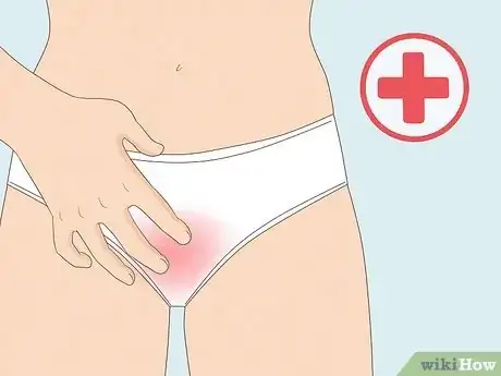 Image titled Treat a Yeast Infection Step 10