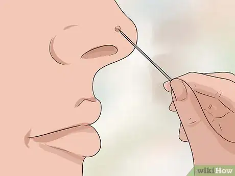 Image titled Treat Ingrown Nose Hairs Step 4