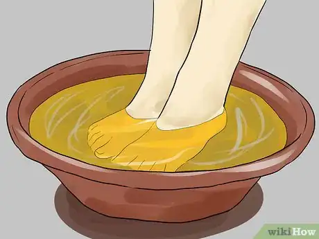 Image titled Use Apple Cider Vinegar for Athlete's Foot Step 4