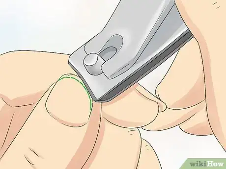 Image titled Grow Your Nails in 5 Days Step 7