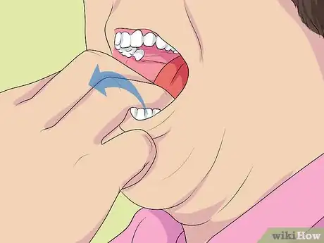 Image titled Apply Denture Adhesive Step 13