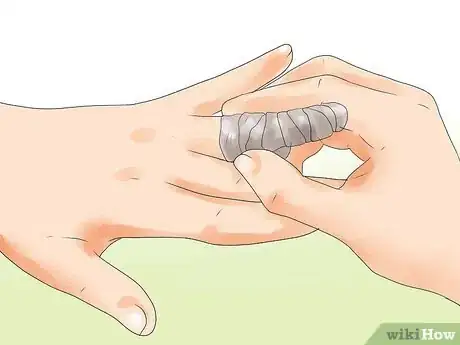 Image titled Make a Huge Blister Heal Step 8