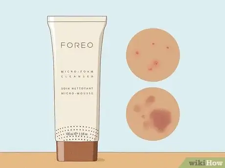 Image titled Best Skincare Products Step 12