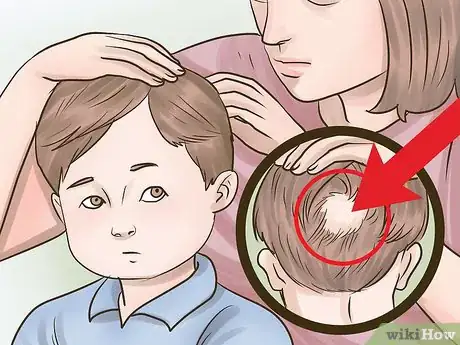 Image titled Stop Hair Loss in Children Step 1