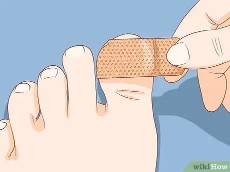 Image titled Help a Toenail Grow Back Quickly Step 7