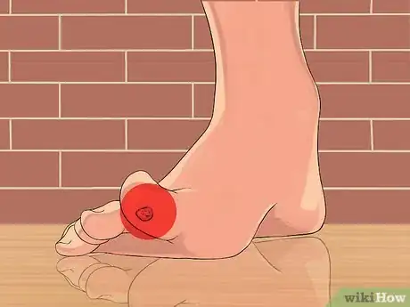 Image titled Get Rid of Plantar Warts (Verrucas) Step 14