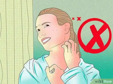 Image titled Relieve Itching from Chickenpox Step 1