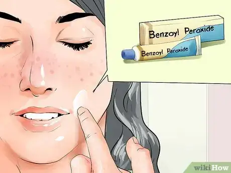 Image titled Get Rid of Acne in One Week Step 5