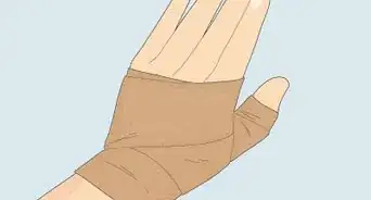 Wrap a Sprained Thumb